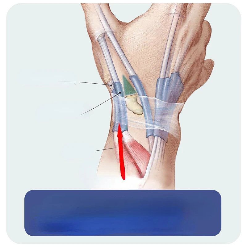 Thumb Sprain Finger Guard Wrist Rehabilitation Ultrathin Tendon Sheath