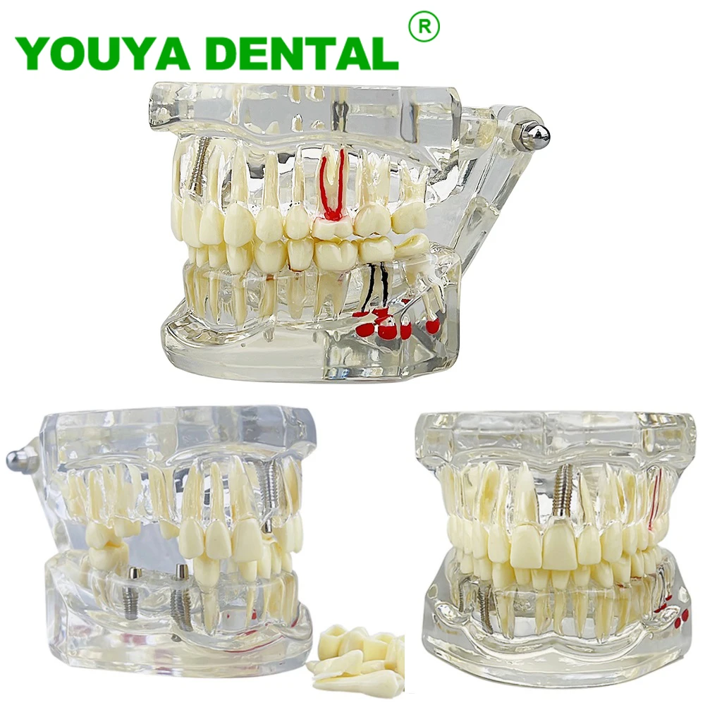 진공 밀봉 포장 교체 브러시 헤드, SOOCAS X3 X3pro X3U X5 V1 D3 전동 칫솔용, 10 개