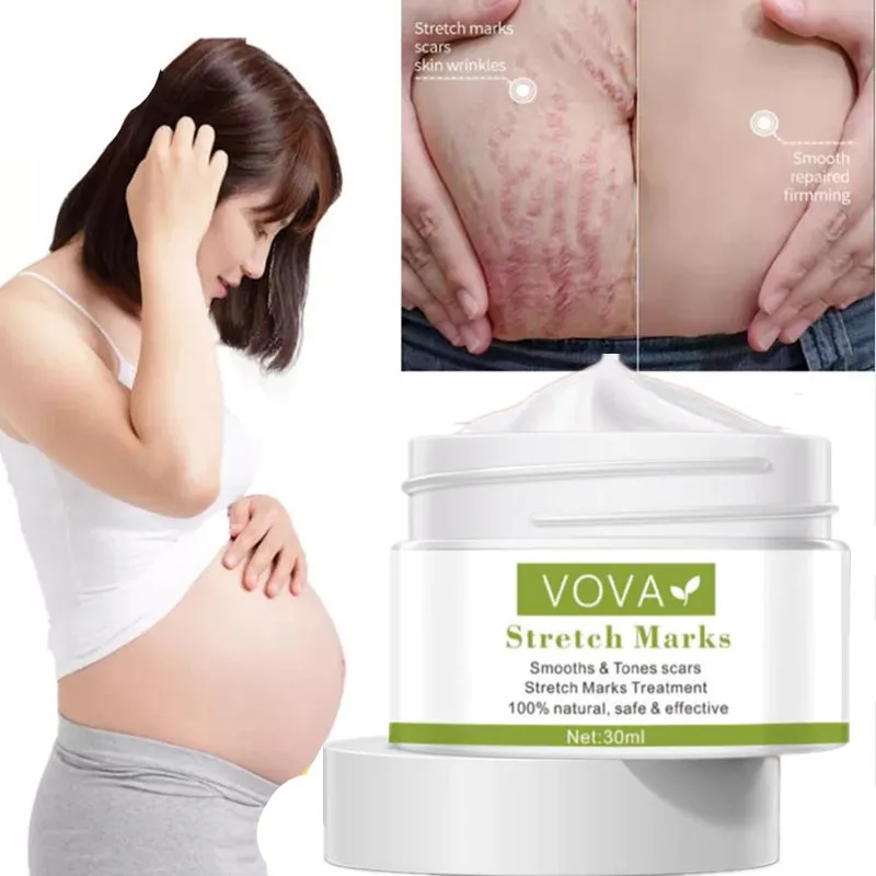 Pregnant Women To Remove Stretch Marks Body Buttocks And Chest Lines
