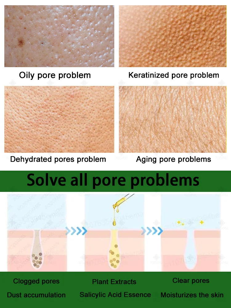 Plant extract facial pore essence Improves large pores Whitens and brightens skin Moisturizes skin