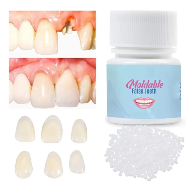 Nuevo Kit De Reparación De Dientes Temporales Con Pegamento Sólido Para  Dientes, Dientes Y Huecos, Pegamento Sólido Para Dientes Postizos, Adhesivo  Para Dentadura Que Te Hace Hermoso De 0,76 €