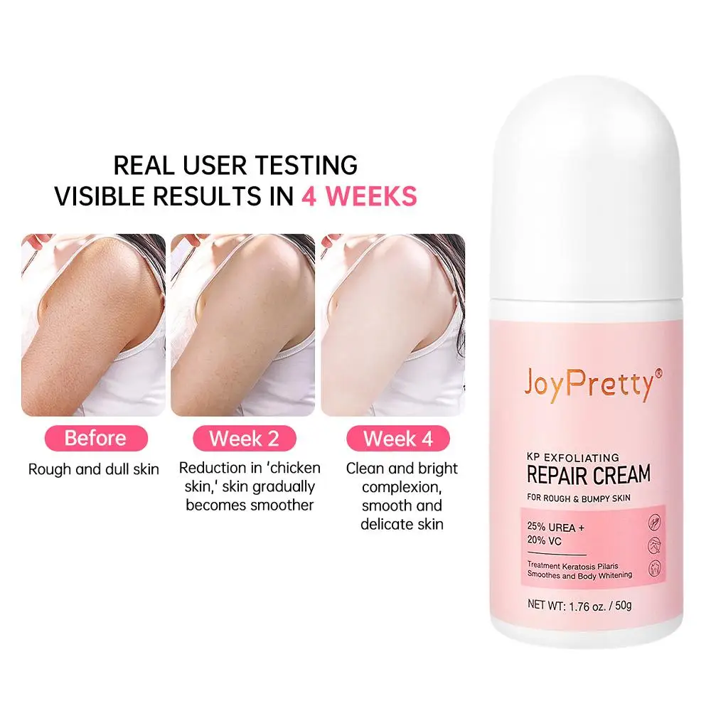 

Body Cream Chicken Skin Removal Treatment Keratosis Lotion 50g Bumpy Whitening Creams Moisturizer Rough Spots Pilaris Pore R4Y1