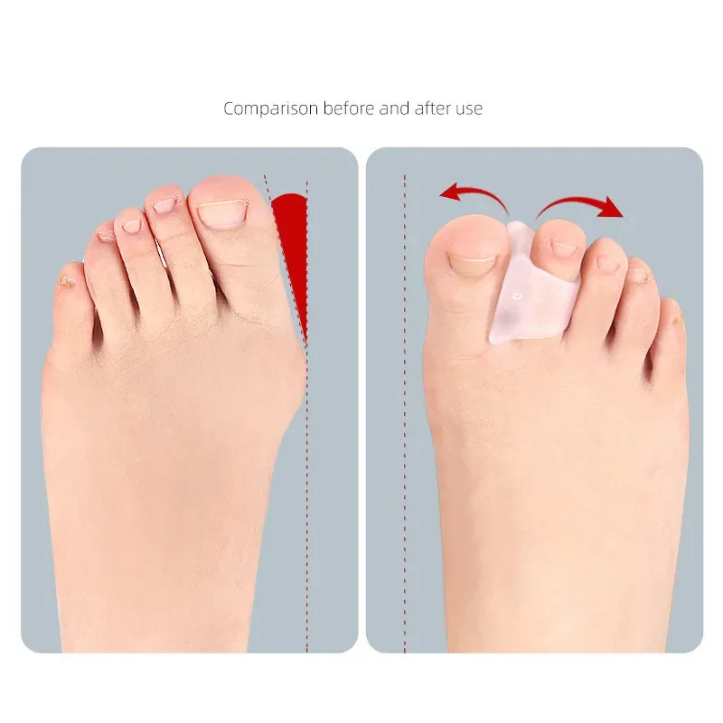 RHBJ New Toe Valgus Correction Device Hammer Shaped Toe Separators Guard Pad Splitter Pain Relief Orthopedic Foot Care Tool