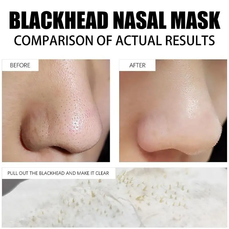 LANBENA New Style Blackhead Remover Nose Mask Pore Strip Black Mask Peeling Acne Treatment Black Deep Cleansing Hudpleje Korea_voghion.com