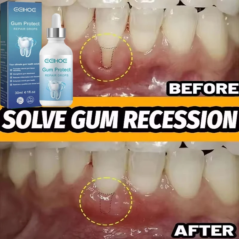 Gum Repair Drops Tooth Decay Repair Rapid Repair Gums Serum for Tooth Allergy