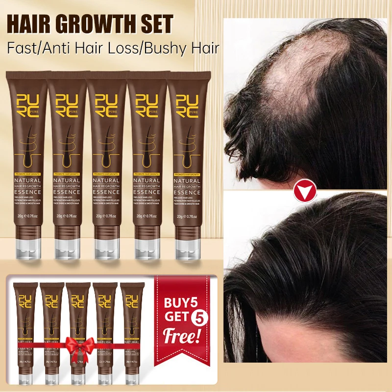 HairGrowthOilGingerAntiHairLossSerumPreventBaldnessScalp