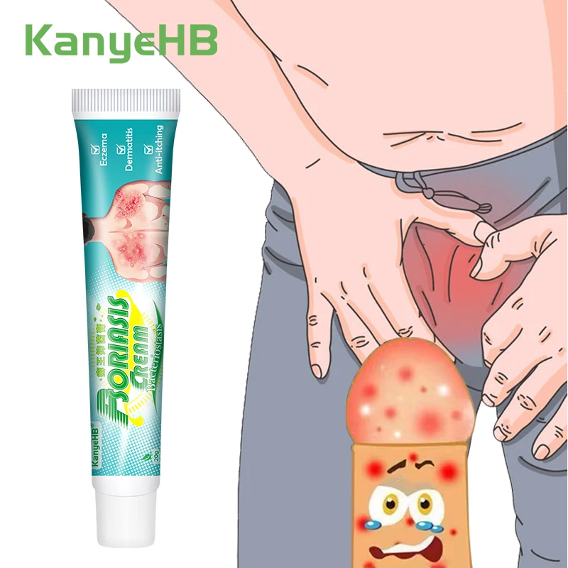 1 шт. Крем для шкіри інтимних частин Антибактеріальний крем проти свербіння Банк Суд Мошонка Екзема Вульбер Запах Головка Свербіж Крем від псоріазу G012