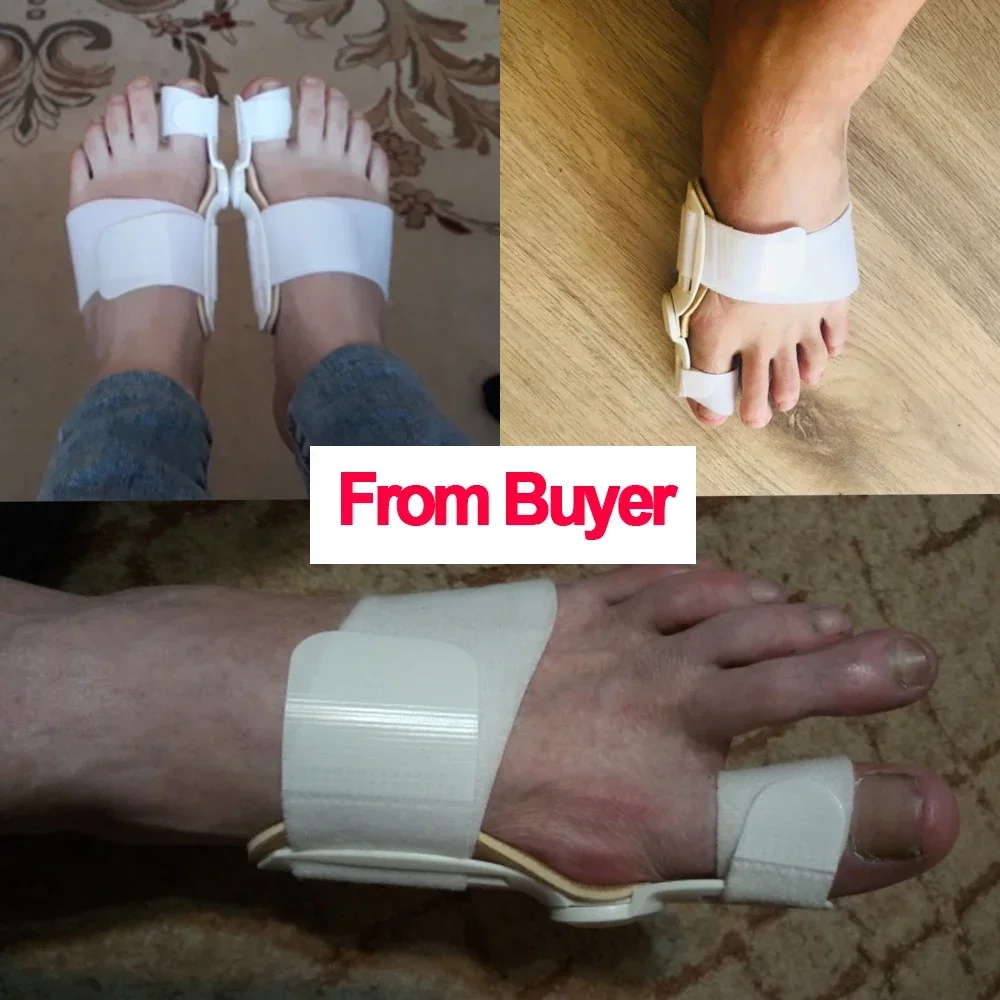 Bunion Corrector Toe Corrector Foot Brace Hallux Valgus Bunions Toes Correction Separator Foot Care