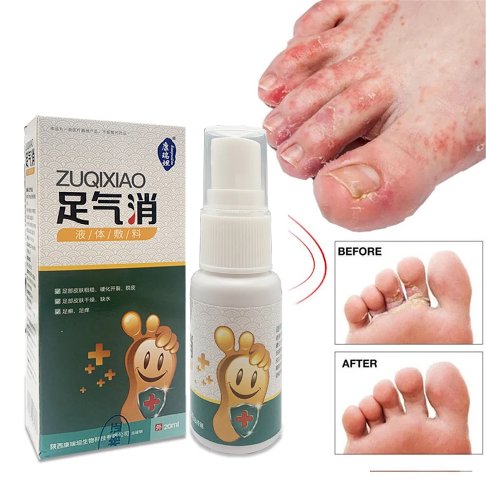 

Спрей от грибка для ног, 20 мл