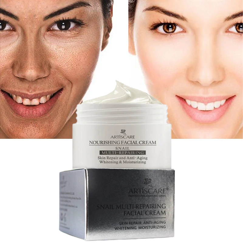 

Snail Repair Face Cream Anti Acne Serum Lotion Moisturizing Gel Sensitive Soothing Softening Shrink Pores Anti-Aging Skin Care