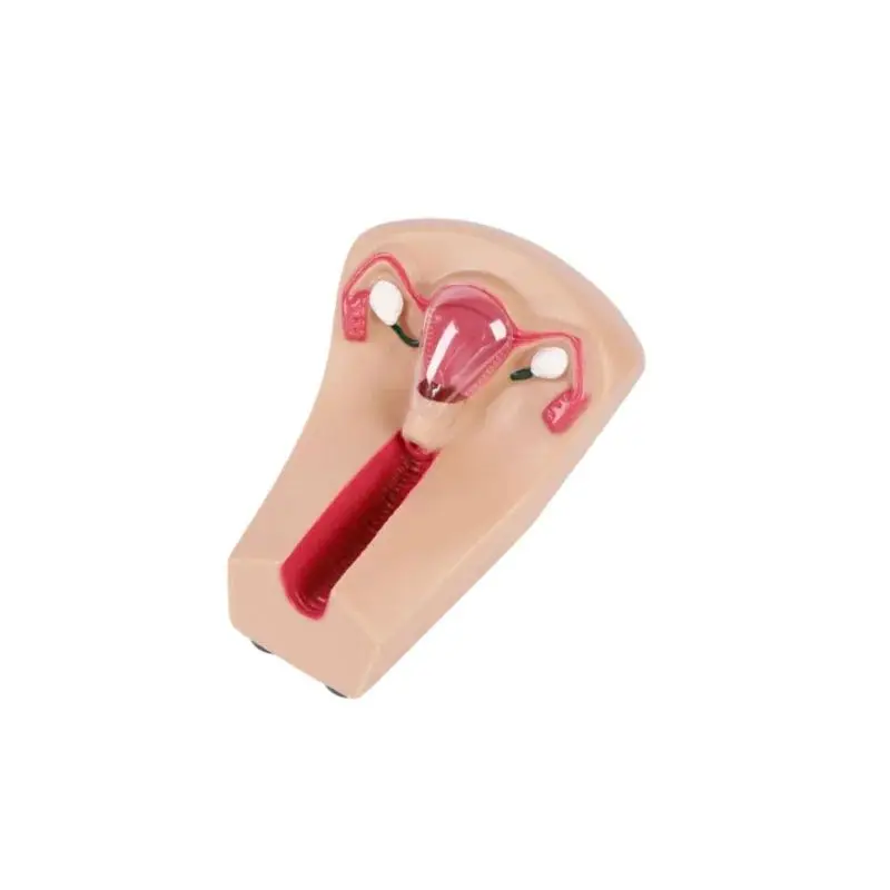 м?￢м мк¶? л н\u201d?м мм№? л?Ёл?ё, IUD нл?Ё мл®￢лмн?°