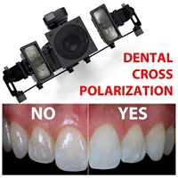 Dental Cross Polarization Kit For Godox MF12 Camera Flash - No Reflections, No Glare Camera Photo Kit Polar Eye For Dentist 1