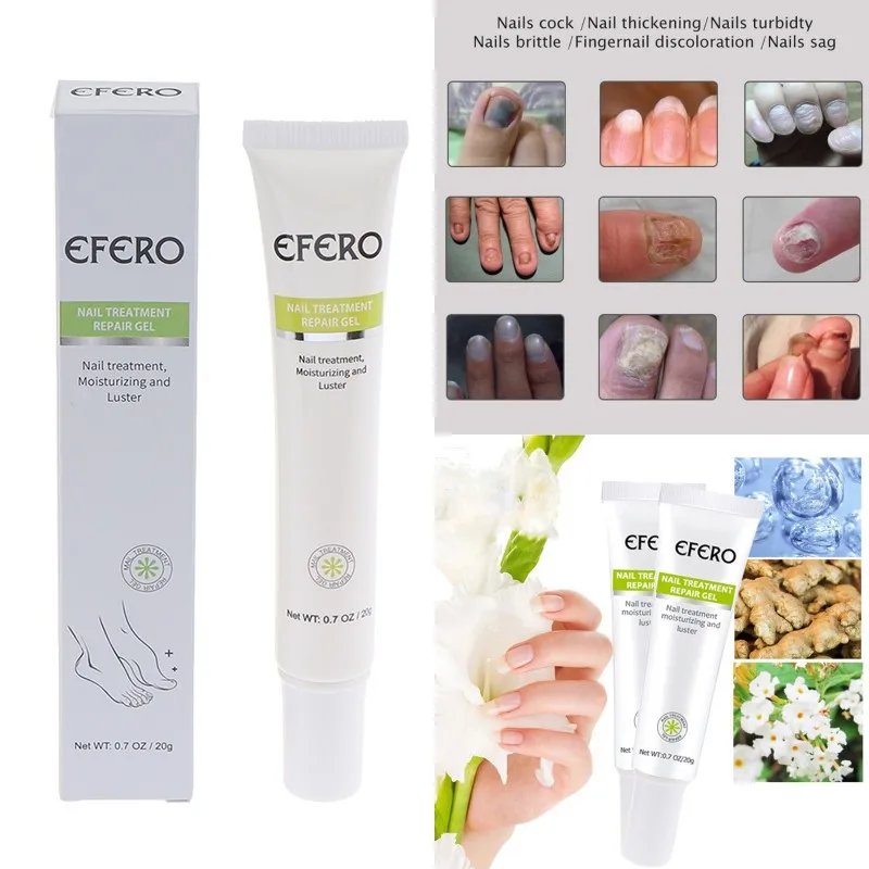 

20g Nail Anti Infection Cream Fungal Nail Treatment Gel Foot Repair Essence Toe Nail Fungus Removal Gel Fungal Nail Removal