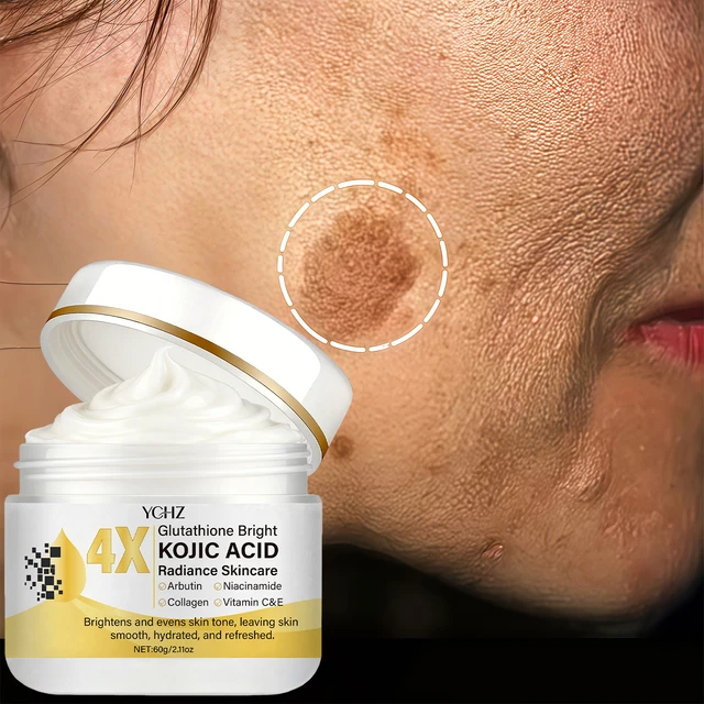 Crème pour le visage à l'acide kojique, unifie le teint, élimine les taches brunes et la terneur - Non grasse, convient aux hommes et aux femmes - Crème éclaircissante et hydratante, pour une utilisation de jour et de nuit - 60g 1
