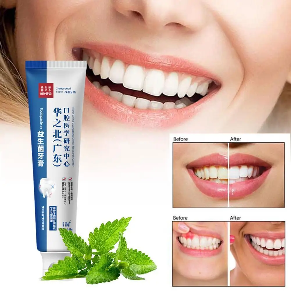 

Sdotter 100g Whitening Teeth Quick Repair Of Cavities Caries Filling Stains Yellowing Teeth Repair Toothpaste Whitening Plaque R