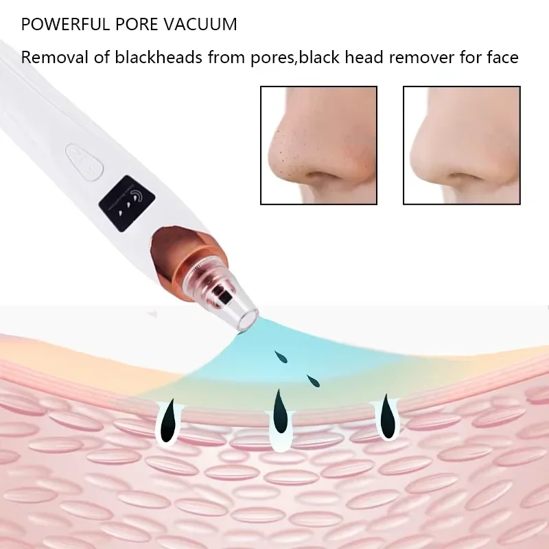 Electric Blackhead Remover Vacuum Suction USB Facial Pore Cleaner Spot Acne Pimple Black Head Extractor Face Clean Skin Care 6