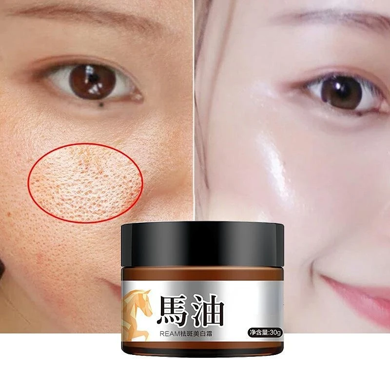 Horse Oil Freckle Cream Fade Stain Sunburn Chloasma Freckles Facial Care