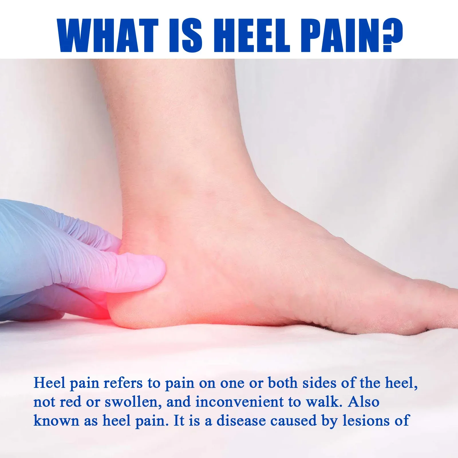 보청기Relief Ointment Plantar Fasciitis Ache Rheumatism Arthritis Treatment Tendonitis Ankle Soreness Heel Spur Pain Cream 무지외반증교정기