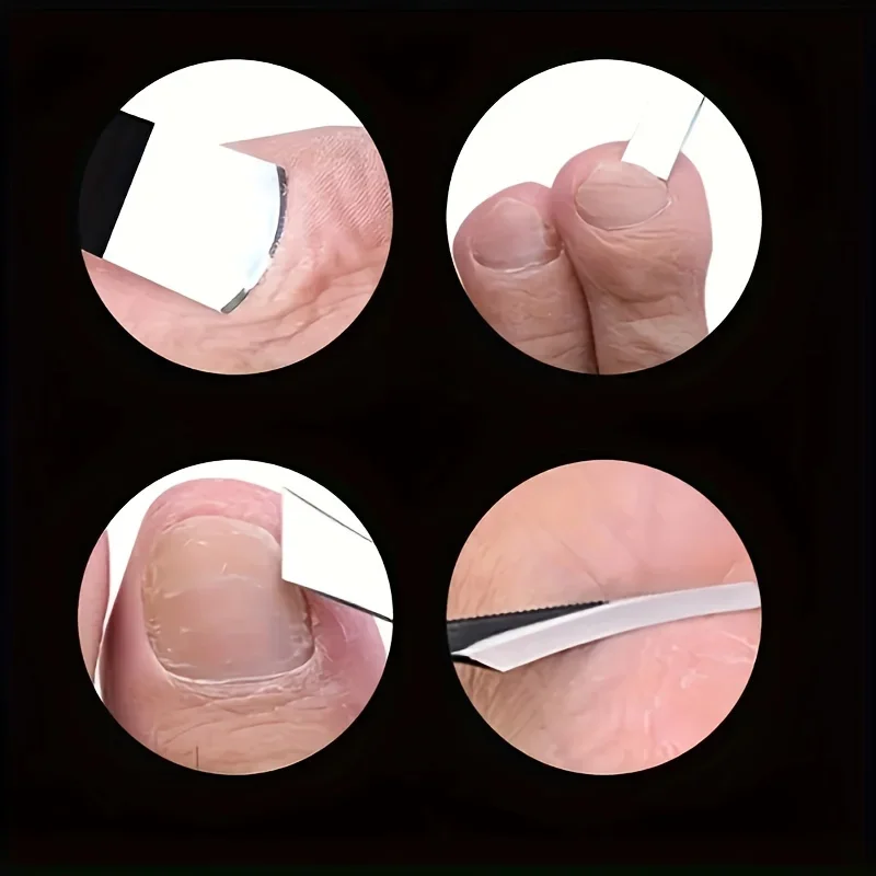 2/6pcs Stainless Steel Foot Care Set Exfoliating Knife Foot Scraper Ingrown Toenail Clippers Dead Skin Remover