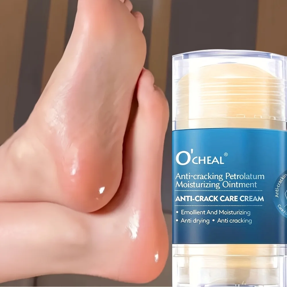 Foot Cream For Dry Cracked Feet Heels