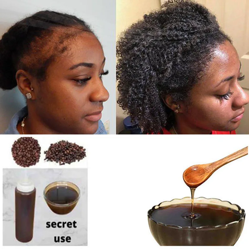 

Africa Women Traction Alopecia Treatment Hair Growth Product for men Chebe Powder Shampoo Hair Loss Treatment Get Rid of Wigs