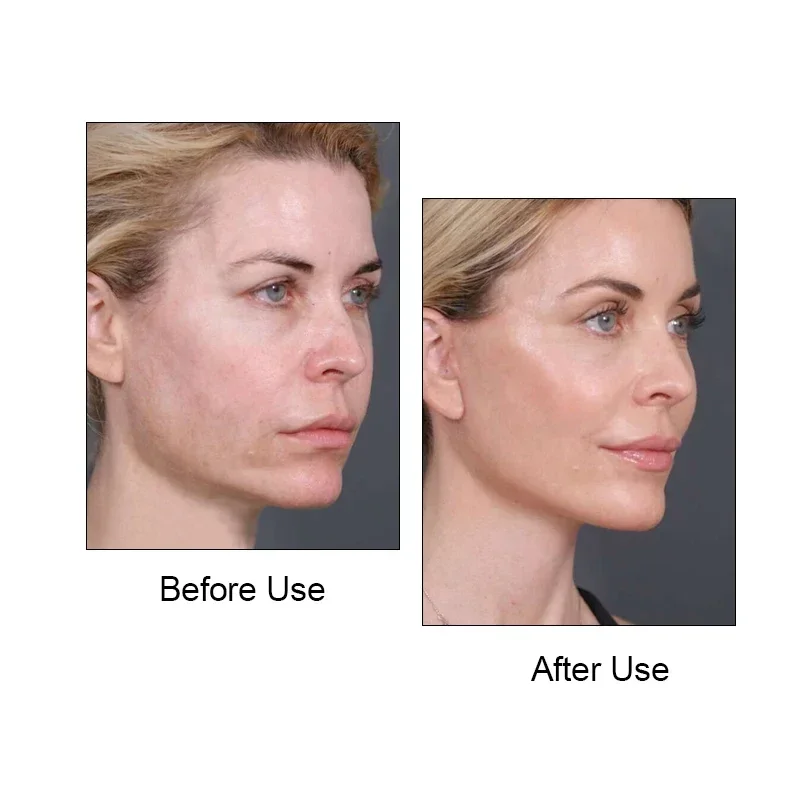 Facial V-shaped shaper, facial slimming bandage, shape lifting reduction double chin facial slimming belt massage face