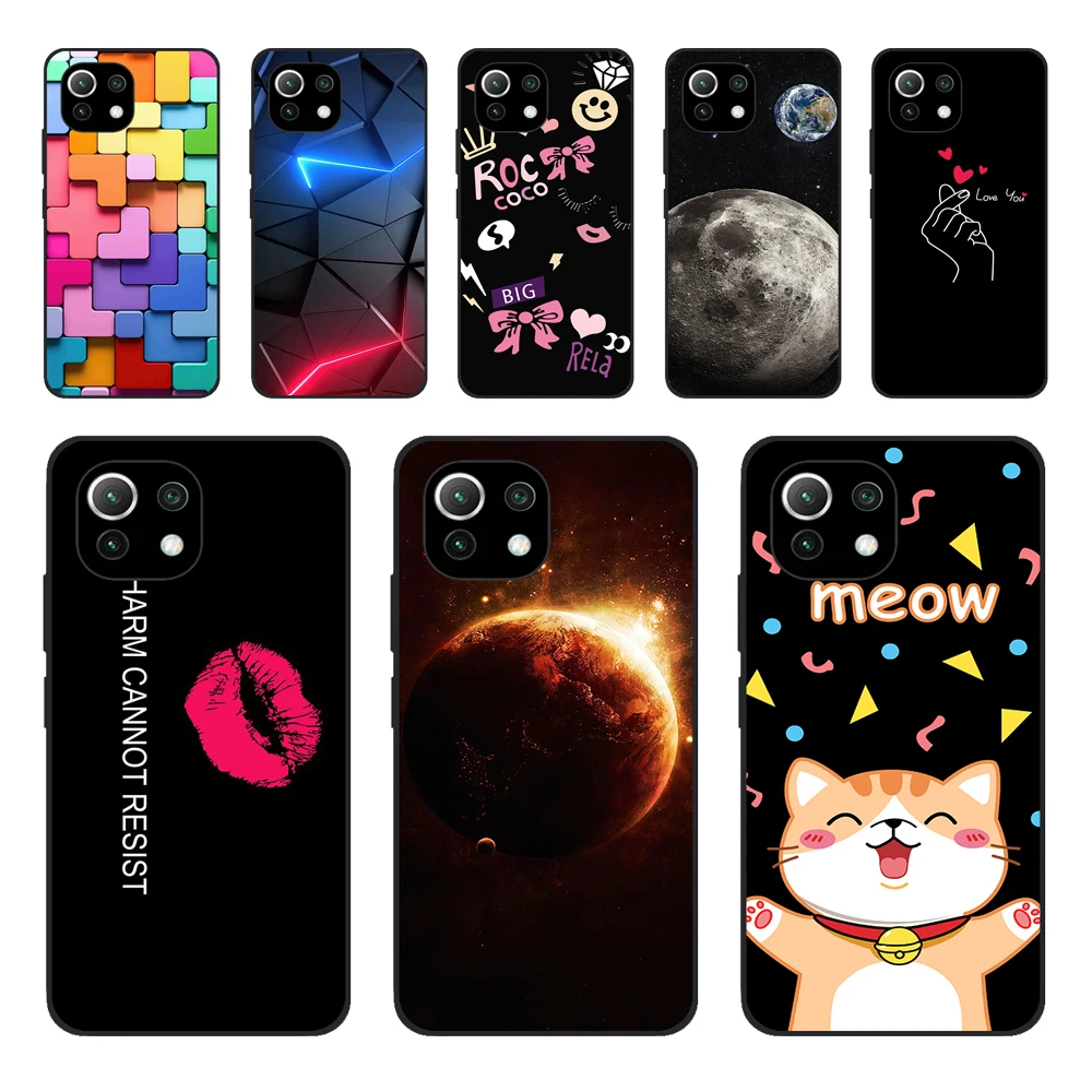 Per Xiaomi Mi 11 | Mi 11 Lite 5G Ne 4G | Mi 11I Case Back Per Xiaomi Mi 11 Ultra Phone Cover Silicon Funda Black Tpu Case