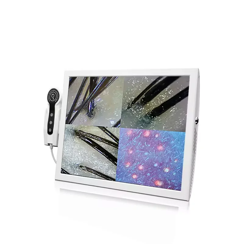 15 Inch HD Display 50/200X Professional Hair Follicle Detector Scalp Machine Oil Moisture Test Digital UV Skin Analysis Machine
