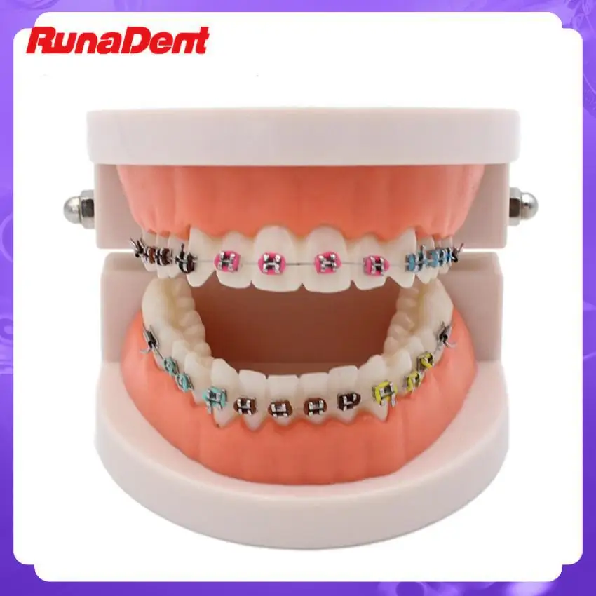 DentalStandardModelTeethwithOrthodonticBracesChanneledSteel