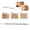 Professional Stainless Steel Blackhead Remover Tool Comedone Acne Pimple 2 Loop Needles Blemish Extractor Remover Skin Care Tool 4