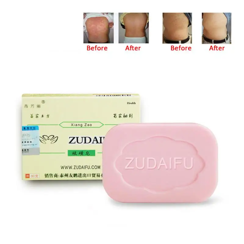 Sulfur Soap Zudaifu Sulfur Soap Cleanser Oil-Control Cure Face Whitening Sulfur Soap Skin Peel Cleanser Handmade