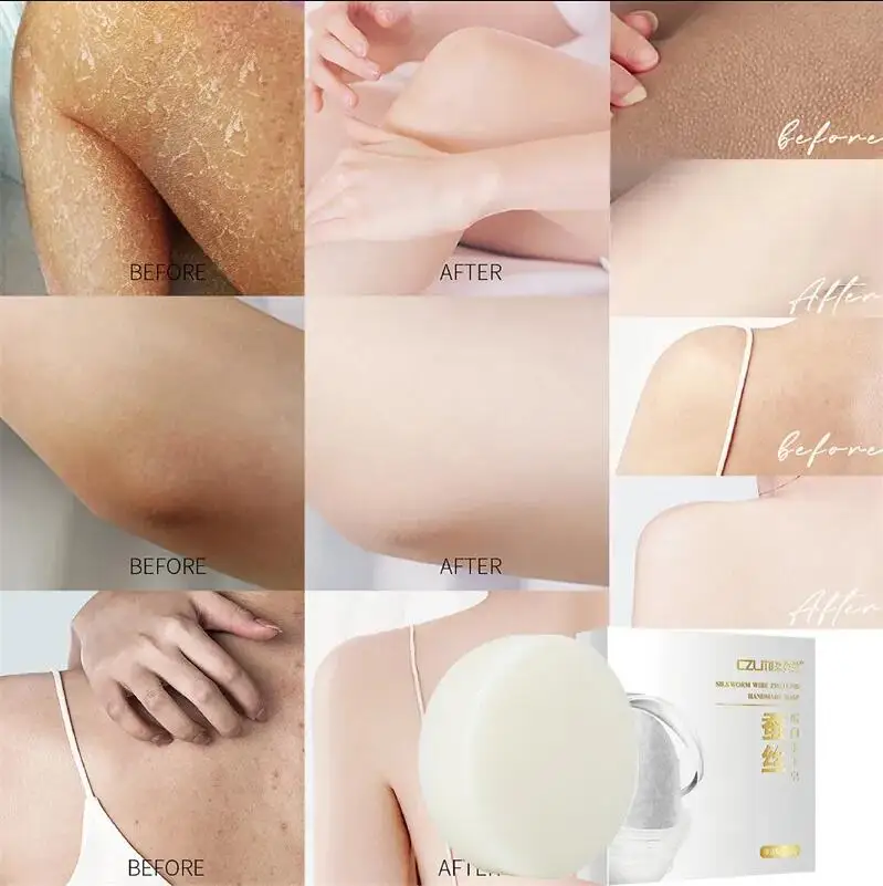 Рисунок 2 - Отбеливающее мыло для тела