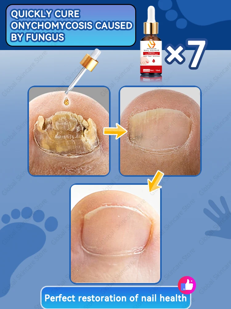 Nail Problem Solving Toenail Fungus Patch Nail fungi Problem product