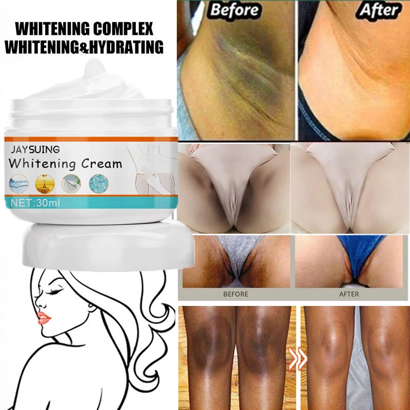 Whitening Cream Face Body Moisturizer Illuminate Dark Skin Neck Under Arms  Armpit Bikini Private Part Knees Elbow Between Legs - AliExpress