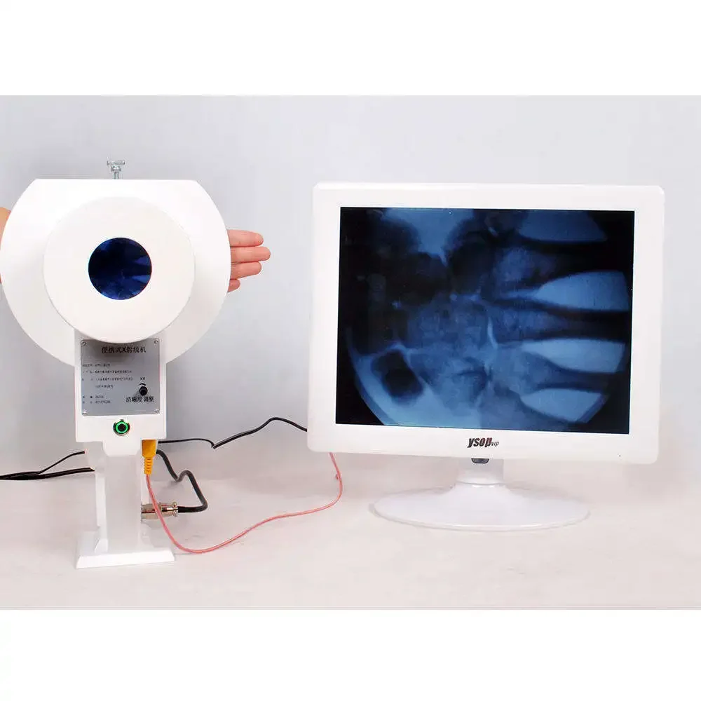 

High Safety Medical Portable X Ray Machine High Frequency Portable X-ray Equipment