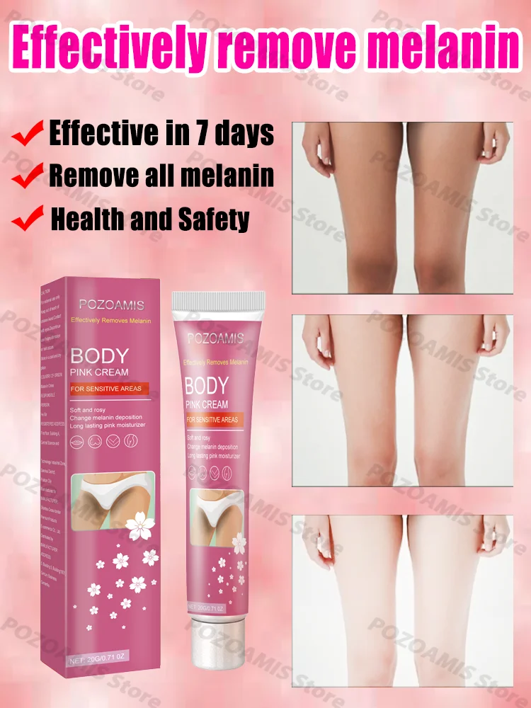 Whitening cream remove freckles and dark spots lighten melanin whitening cream