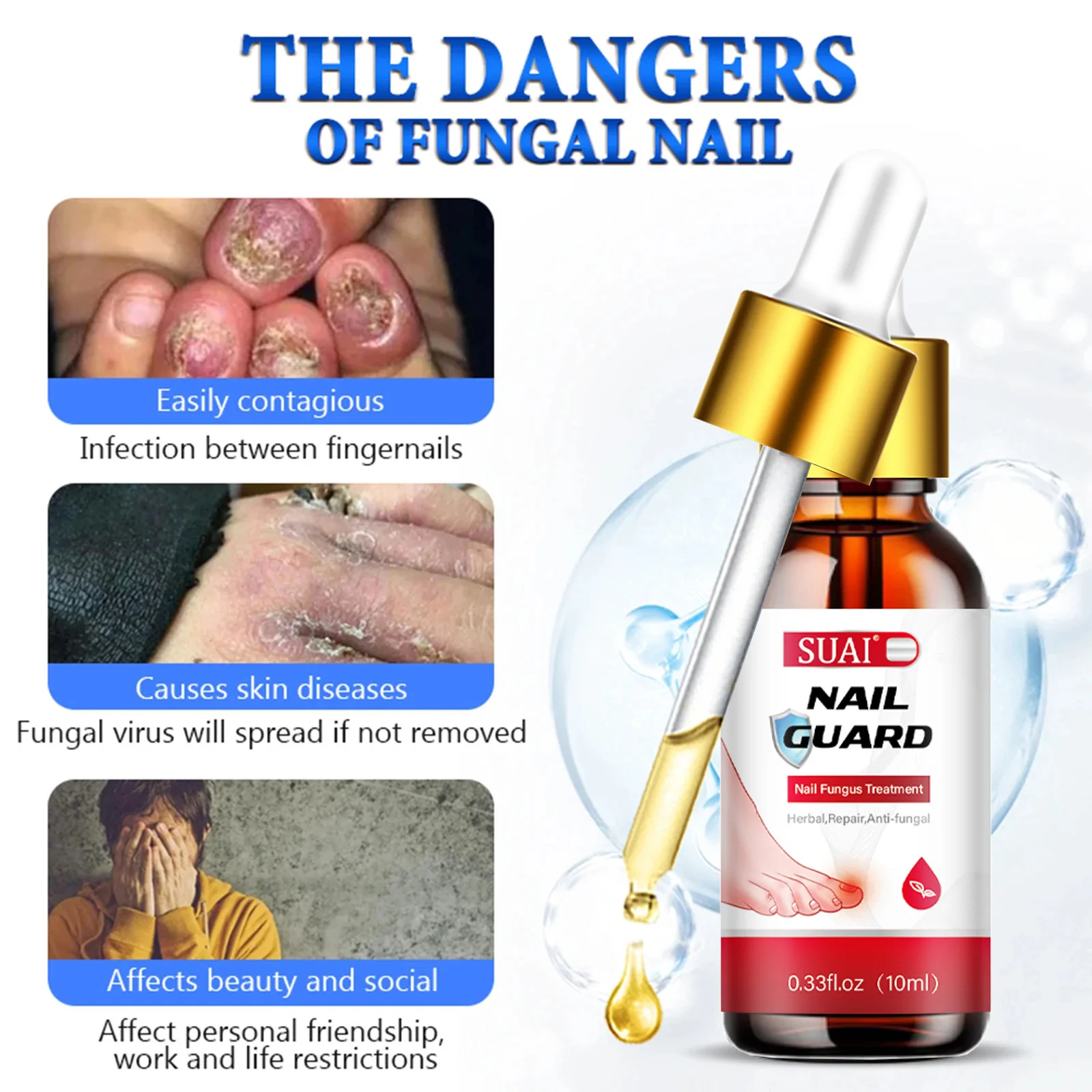 u&ntilde;asFungal Nail Device Repair Fast Nails Fungus Onychomycosis Repair Nails Toenail Fingernail Removes Nail Fungus Foot Treatment nail fungus remover