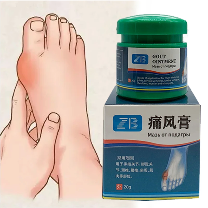 Bunion Gout Pain Relief Ointment Uric Acid Toe Joint Crystal Removal Valgus Corrector Cream Hallux Knee Lumbar Treatment