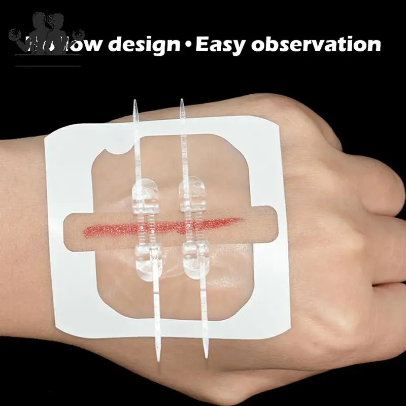 Zipper Band-aid Painless Wound Closure Device Suture-free Wound Dressing Patches Zip Suture Reducer Band Aid