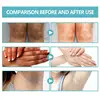 Brighten Cream Bleaching Armpits Elbows Knees Moisturizing Body Lotion Cream Brightening Lightening Melanin Skin Cream 6