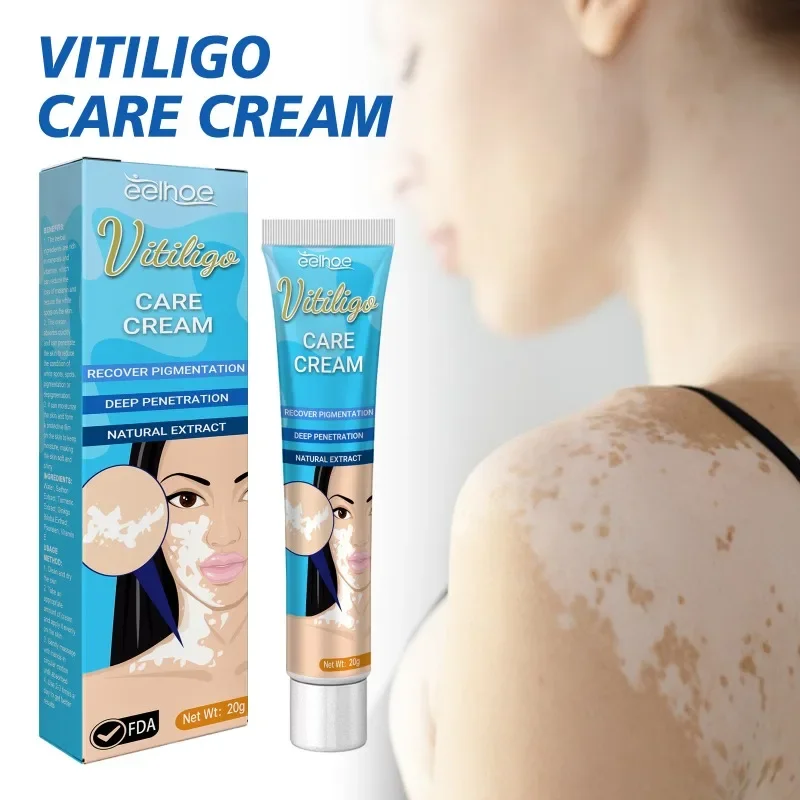 

Herbal Vitiligo Ointment Remove Ringworm White Spot fade Removal Skin sweat spots Leukoplakia Disease Treatment care Cream