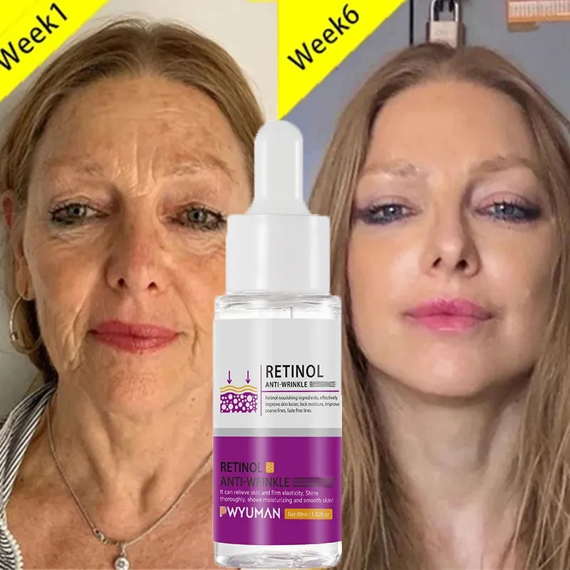 

Retinol Wrinkle Removal Serum Anti-aging Repair Serum Improve Dullness Nourish Firming Skin Smooth Face Beauty Care Products