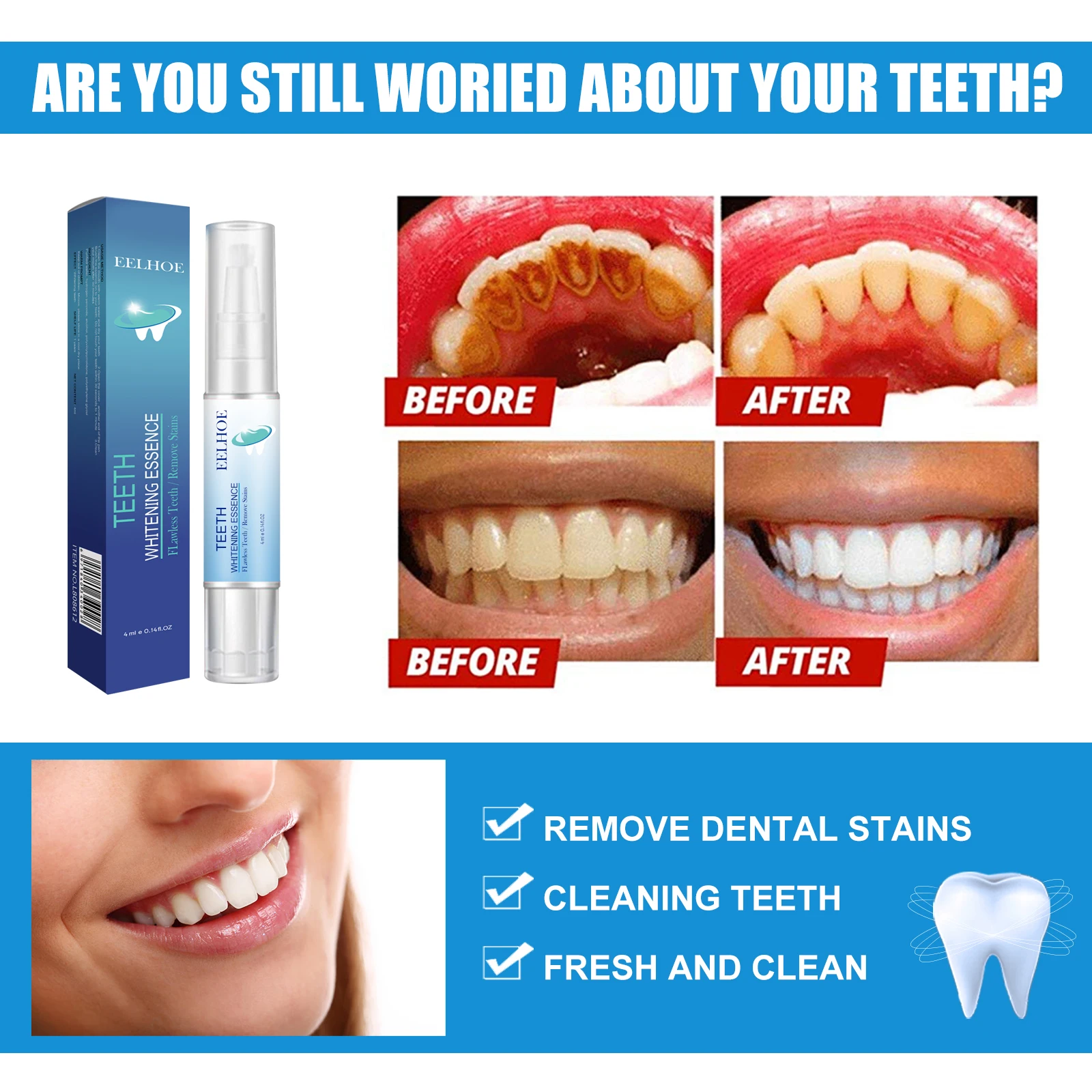 Teeth Cleaning Pen Removes Stains Cleans Teeth Freshens Breath Spots Prevents Bad Breath Cleans Mouth White Pen