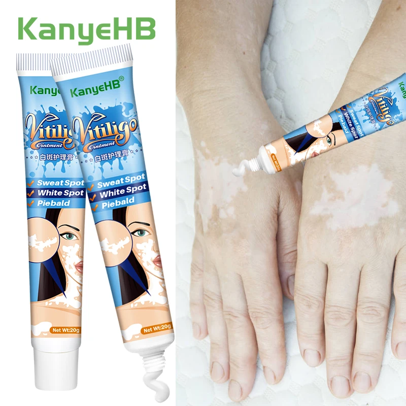 

2/4/6Pcs Effectively Remove Vitiligo Ointment Remove Ringworm White Spot Remove Skin Vitiligo Eliminate Vitiligo Skin Care Cream