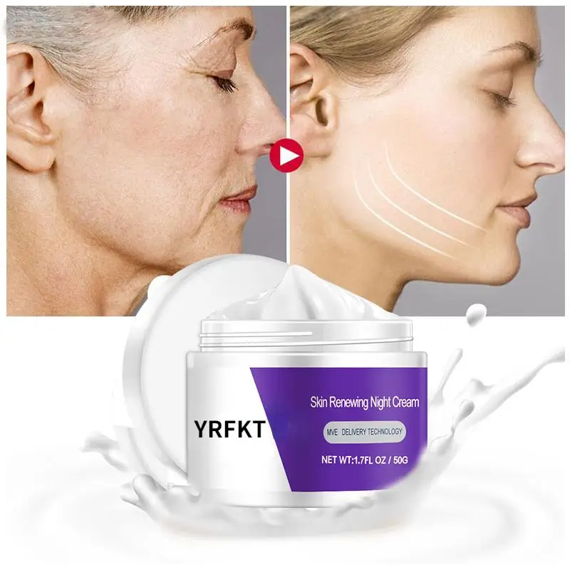 Dark Spot Removal Whitening Skin Cream Remove Melasma Acne Spot Pigment Melanin Dark Spot Pigmentation Moisturizing Gel remove melanin exfoliating oil bleaching dark skin mud rubbing pore cleaner spots removal whitening cleaning yellow peeling oil