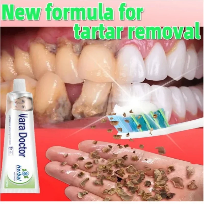 Dental Calculus Remover Whitening Teeth Mouth Odor Removal Bad Breath Preventing Periodontitis Oral Health Care