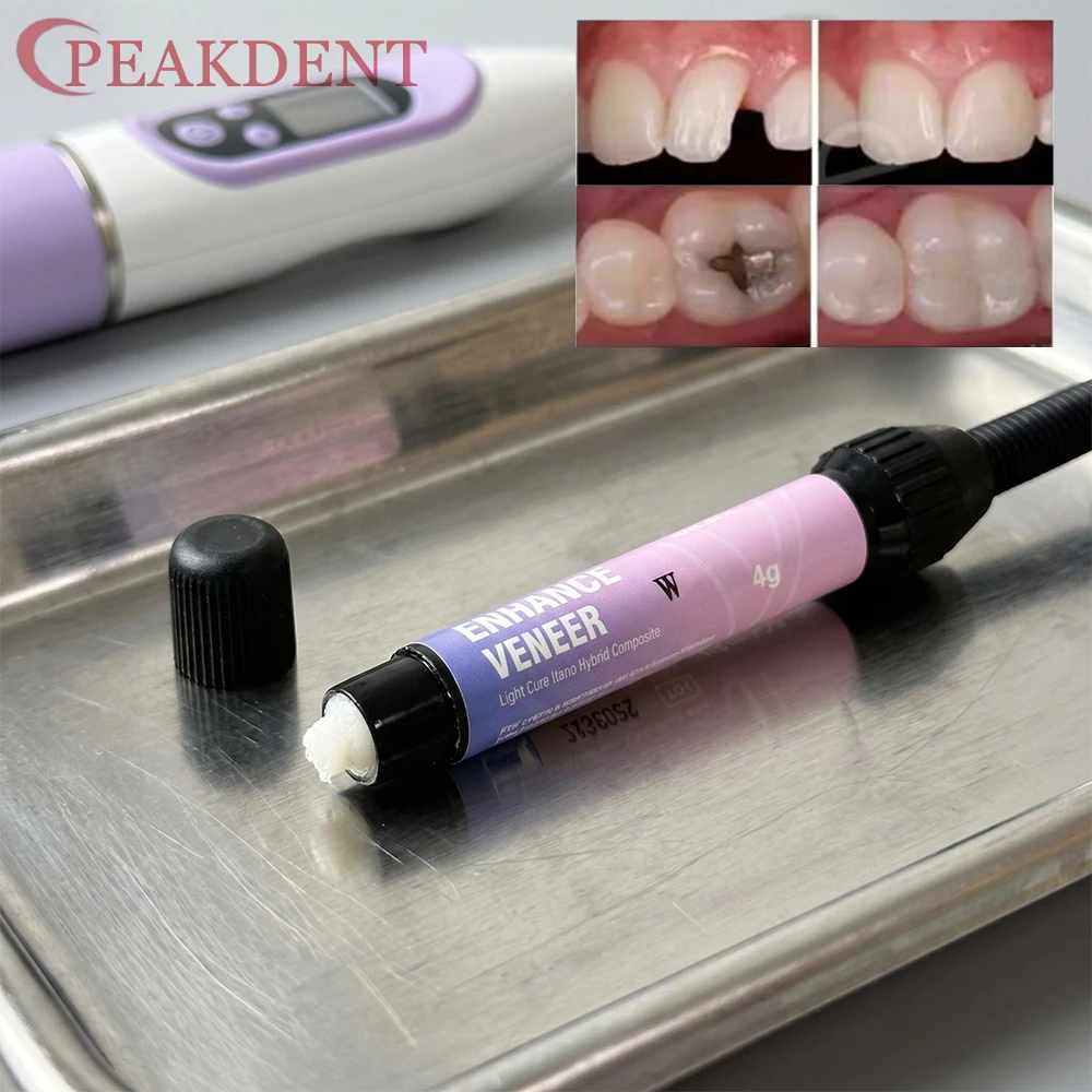 Materiale per Faccette Dentali 4g per Sbiancamento Denti, Resina Composita Fotopolimerizzabile Bianco Brillante, Materiali per Faccette in Ceramica Colore Bianco Perla - immagine 2