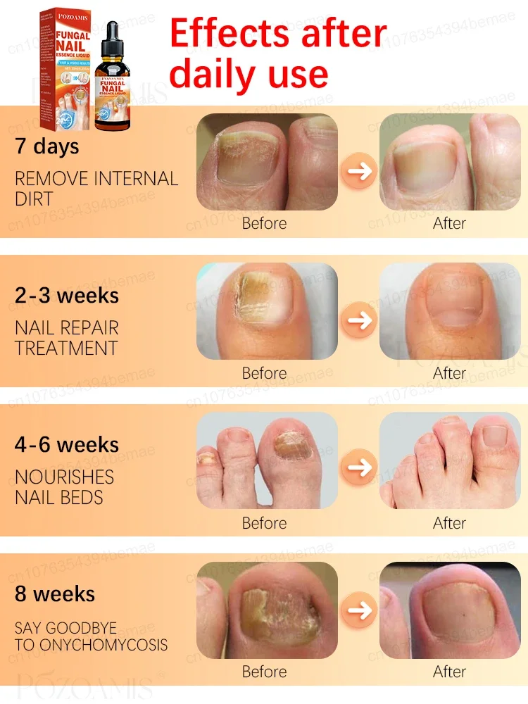 Effective within 7 days
