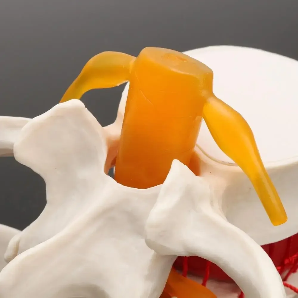 Human Anatomy Skeleton Spine Lumbar Disc Herniation Teaching Model Brain Skull Traumatic Pistol School Supplies Medical Instrument human skull model