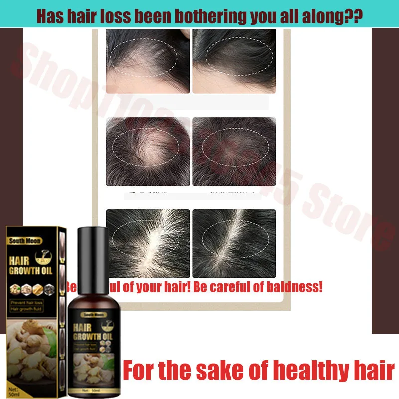 

Ginger Hair Growth Product Anti Hair Loss Serum Liquid Fast Grow Prevent Baldness for Men Women Hair Care Essential Oil